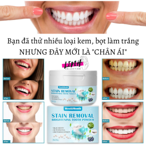 Kem đánh trắng răng loại bỏ mảng bám cao răng