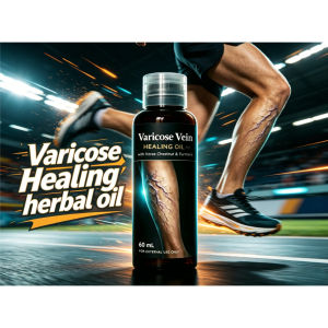 Varicose Vein Healing herbal oil