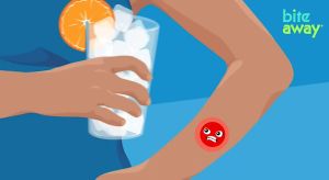 [HOT SALES]Bite Away - The Original Electronic Bug Bite Treatment For Mosquito Bites Made In Germany. Without Chemicals - Treatment By Heat Up To 300 Applications Possible With The First Set Of Batteries