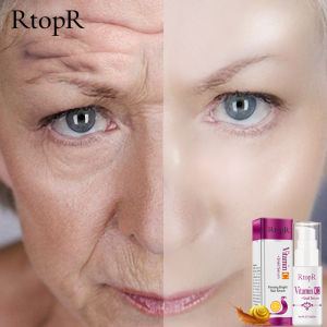 RtopR 3PCS Snail VC Anti Wrinkle Serum Face Acne Treatment Serum Effectively Repairs Pore Firming Bright Skin Emulsion 20ML