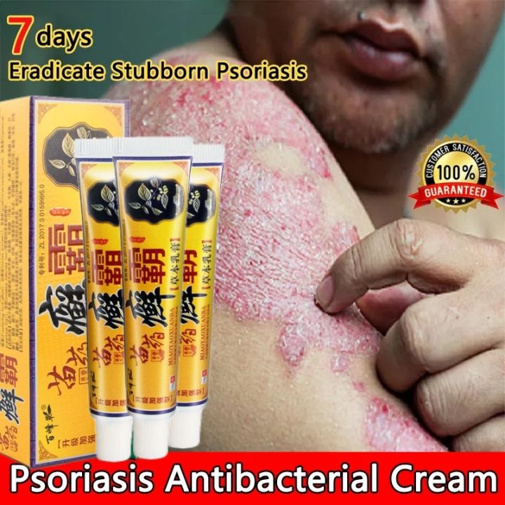 100% Effective Sumifun Eczema Treatment Cream Atoderma Cream Original ...