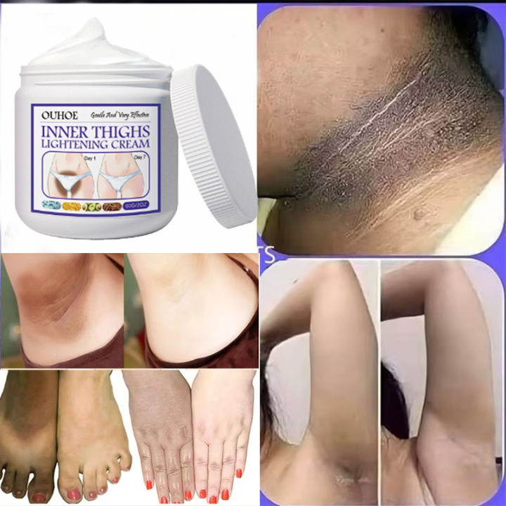 Whitening Cream for Dark Spot Underarm Whitening Bleaching Cream