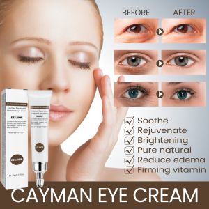 💕【Eliminate Wrinkles In 30 Seconds!】Anti-Wrinkle Essence Eye Cream/Jojoba Oil Firming And Lifting Eye Cream/Lighten Eye Lines And Dark Circles Repair Eye Cream/Wrinkle Elimination Anti-Aging Eye Cream/Eye Repair Cream
