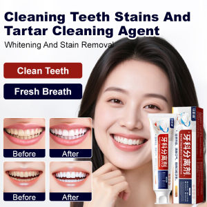 💕Whitening and Refreshing💕Cleaning Teeth Stains Tartar Cleaning Dental Separators Solid Teeth Cleaning Teeth Stains Refreshing Breath Tooth Soreness and Swelling Genuine Products牙膏