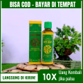 Obat Cedera Engkel, Nyeri Pergelangan Kaki, Ankle Sprain, Keseleo, Kaki Terkilir, Kaki Bengkak, Luka Memar, Patah Tulang, Obat Untuk Cedera Ankle, dgn Minyak Sapu Jagat DI URUT. 