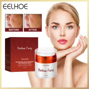 EELHOE Baihua Fang Remove Melasma Dark Spot Acne Marks Lightening Melanin Brightens Skin Tone Face Skin Care Lightening Blemish Removal Serum Reduces Age Spots Freckles Face Cream Whitening Fade Cream Lightening Blemish Removal Serum Reduces Age Spots
