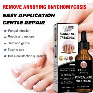 agetet EELHOE Nail Repair Liquid Thickening Bright Nail Removing Onychomycosis Dead Skin Repair Moisturizing Nail Art Nutrient Nursing Liquid