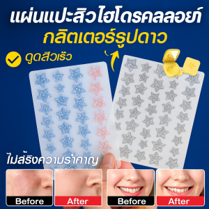 คอลลอยด์ สติ๊กเกอร์สิว ผงแวววาว ติด คอลลอยด์ สติ๊กเกอร์