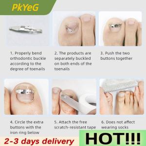 PkYeG Ingrown Toenail Tools Pedicure Recover Embed Toe Nail Treatment Professional Foot Care Correction Tool Care Foot