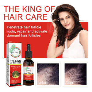 Hair Growth Oil Repair Damaged Hair/ Penumbuh Rambut Serum Minyak Esensial Penumbuh Rambut  30ML