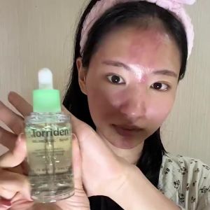 NEW Torriden BALANCEFUL Cica Serum for Sebum and Dead Skin Cells for acne prone skin 50ml