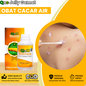 Obat Cacar AirObat Cacar Air Anak Dan Dewasa Obat Gatal Berair Obat Bintik Bintik Berair Gatal Obat Cacar Bernanah Obat Penghilang Bekas Luka Cacar Obat Gatal Cacar Obat Cacar Bisul Dengan Qnc Jelly Gamat