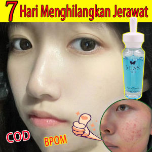【BPOM】MISS YOUTH SERUM ANTI JERAWAT DAN BEKAS-Brightening dan Acne Serum 30ml jerawat dan bekas jerawat Hydrating Serum Essence Wajah/ serum bekas jerawat pria/ serum mencerahkan wajah kusam/Obat Jerawat Ampuh/krim penghilang jerawat dan komedo