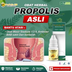 Obat Wasir Keluar Benjolan Ambeien Stadium 1 3 4 Benjolan Anus Sakit Bab Berdarah Herbal Propolis SM