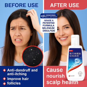 Xie Kangwang Anti-Dandruff Oil Control Refreshing Anti-Itching Shampoo Psoriasis Shampoo Scalp Itching Hair Treatment