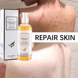 Acne body wash ubat jerawat badan Whitening sabun hilangkan badan Whitening Anti-acne Shower Gel men women Remove chicken skin mites back acne moisturizing body wash for sensitive skin