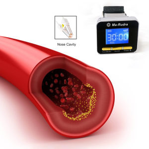 Chinese Traditional Cold Laser Therapy Watch For Three High Lower Cholesterol Diabetic Care Improve Blood Circulation Elderly Home Health Wellness Device