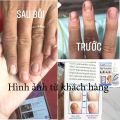 [HCM]Dung dịch cải thiện nấm móng Varisi Nail Solution nhập khẩu USA chính hãng. 