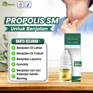 Propolis SM Untuk Benjolan Tiroid Lipoma Kelenjar di Tubuh Benjolan Uci Uci - Pengempis Benjolan Leher Tangan Kaki Untuk Dewasa dan Anak
