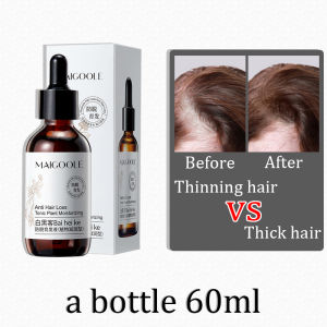 Hair Growth Serum minyak rambut cepat panjang dan lebat 60ml tonic Herbal biotin supplement for hair growth women man Prevent hair loss Shampoo