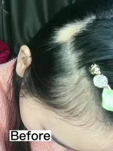 Rosemary 、 Onion and Black Seed 3-in-1 Hair Growth Spray  -  Control shedding and promote growth