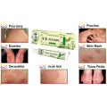 Zudaifu antibacterial cream for itchy and skin disease like allergy, dermatitis, psoriasis, eczema, antifungal treatment. 