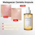 SKIN1004 Madagascar Centella Ampoule 100ml Repair skin acne marks and strengthen skin barrier. 