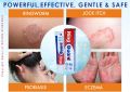 Ring Guard + 7 Days For Anti-Fungal Medicated Cream 12gm. 