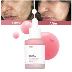 Peptide Collagen Serum Remove Acne Essence Enhances Skin Radiance Provides Deep Hydration Smooths Skin Texture Korean Products2026