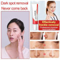Original Whitening Freckle Cream Pekas Remover FOR ALL SKIN TYPES Melasma Remover Oitment Melasma Cream Pantanggal ng Pekas Pantanggal ng Melasma. 