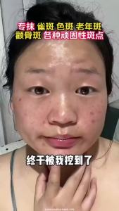 Buy 2 Get 1 Free 377 Aofu Snow Radiance Whitening and Spot-Removing Cream Whitening Spot Removing Cream 50g Whitening And Brightening Skin Tone