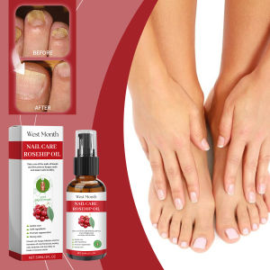 West Month Nail Care Oil Anti-Nail Groove Safety Repair Toenail Treatment Oil Anti Bacterial Toenail Repair Liquid 30ml