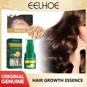 Eelhoe Ginger Hair Growth Mist Scalp Massage Moisturizing Thick Hair Hair Care Nutrition Spray Hair Growth Spray Ginger Anti Hair Loss Essential Oil Treatment Scalp Fast Hair Growth Spray Serum