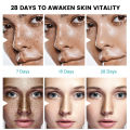 Sumifun Cream Penghilang Flek Hitam Whitening Freckle Cream Krim Bintik Melasma Mencerahkan Kulit Efektif Menghilangkan Bintik Hitam 20g. 