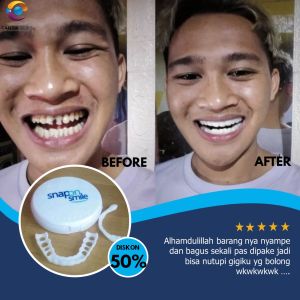 Snap on Smile Veneer Gigi Palsu Original Asli Lepas Pasang Atas Bawah Permanen Kuat Bisa Buat Makan Siap Pakai Pria Wanita Dewasa