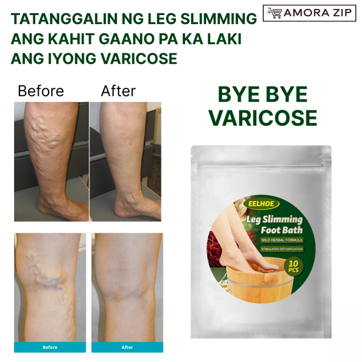 Hot Lymphatic Drainage Ginger Foot Soak Leg Slimming Foot Bath Weight