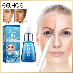 Eelhoe V89 Probiotic Concentrate Anti-Wrinkle Serum Hyaluronic Acid Anti Aging Brightening Cream Facial Lifting Firming Daily Skin Care Mineral Face Serum Probiotic Concenteate Moisturizing Anti-aging Anti-Wrinkle Fine Lines Lift Firm Brighten