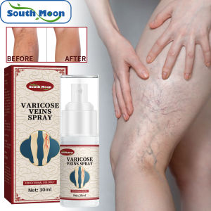 Mặt Trăng nam giãn tĩnh mạch phun viêm mạch tĩnh mạch chân nhện đau Relief điều trị làm mịn mạch máu đỏ chăm sóc thảo dược dành cho cơ thể chân giãn nở đau thảo dược làm đẹp chăm sóc da cơ thể