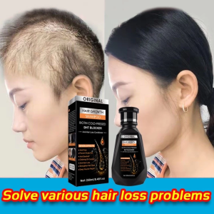 250ML Ginger Shampoo Hair Grower 7 Day Fast Hair Growth Hair Thickener and Ginger Shampoo Hair Growth Horse Shampoo Ketoconazole Shampoo