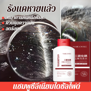 แชมพูขจัดรังแคซีลีเนียมไดซัลไฟด์ แชมพูรังแค แชมพูคัน ลดรังแค ควบคุมความมันและบรรเทาอาการคัน บรรเทาอาการผิวหนังอักเสบจากเซ็บเดิร์ม