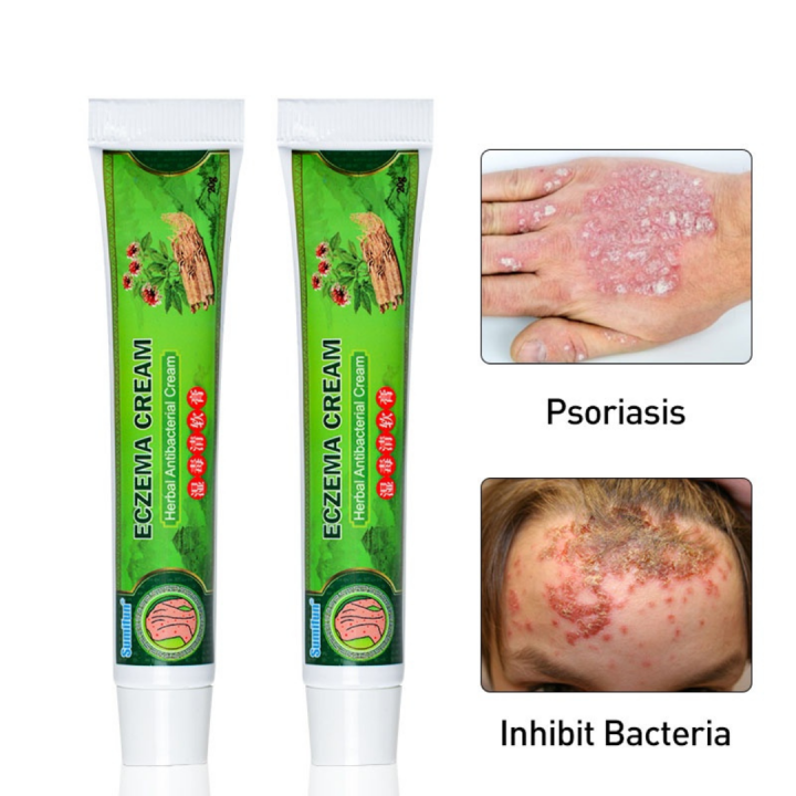ECZEMA treatment CREAM gamot sa kati kati sa balat anti fungal cream ...
