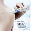 DERMATIX Sillicone Gel Krim Salep Obat Penghilang Bekas Luka Strechmark Ampuh Koreng Hitam Di Kaki Jerawat Dermatix Ultra Original Salep Luka Bakar Dan Stretch Marks-15g. 