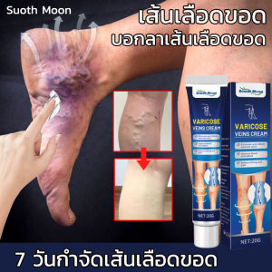 ครีมทาเส้นเลือดขอด ครีมเส้นเลือด ยาทาเส้นขอด เส้นเลือดขอด รักษาขาให้สวย รักษาขาให้สวย ครีมหลอดเลือดดำบอกล