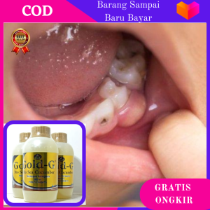 Obat Abses Gigi Gusi Bengkak Gusi Berdarah Gigi Berlubang Gusi Bernanah Sariawan Radang Gusi Gigi Periodontitis Gingivitis Abses Gigi Perikoronitis Paling Ampuh Untuk Dewasa dan Anak-Anak Bisa