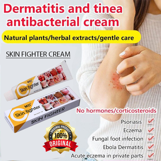 SH Antifungal antipruritic ointment for seborrheic dermatitis eczema