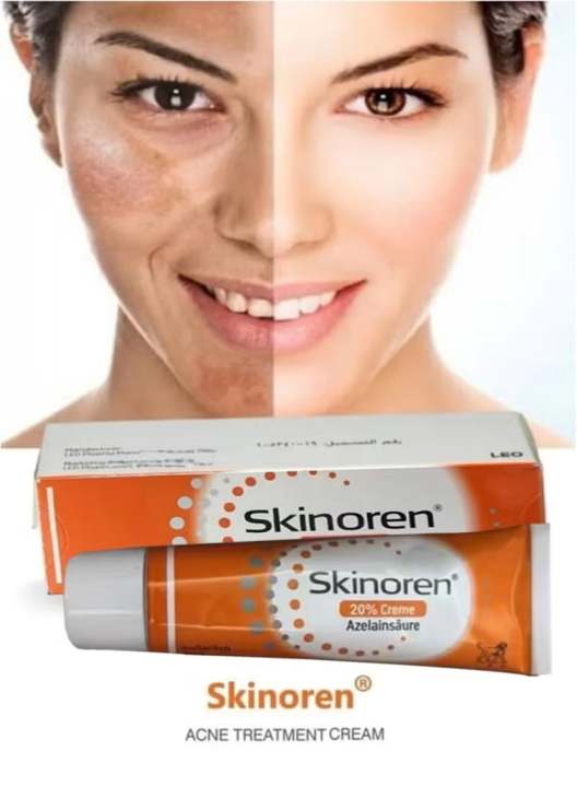 Skinoren%20%E0%B8%84%E0%B8%A3%E0%B8%B5%E0%B8%A1%E0%B8%97%E0%B8%B2%E0%B8%AA%E0%B8%B4%E0%B8%A7%2030g%20%E0%B8%A3%E0%B8%B1%E0%B8%81%E0%B8%A9%E0%B8%B2%E0%B8%97%E0%B8%B1%E0%B9%89%E0%B8%87%E0%B8%AA%E0%B8%B4%E0%B8%A7%20%E0%B8%9D%E0%B9%89%E0%B8%B2%20%E0%B8%81%E0%B8%A3%E0%B8%B0%20%E0%B9%81%E0%B8%A5%E0%B8%B0%E0%B8%A3%E0%B8%AD%E0%B8%A2%E0%B8%94%E0%B8%B3%E0%B8%88%E0%B8%B2%E0%B8%81%E0%B8%AA%E0%B8%B4%E0%B8%A7%20%E0%B9%80%E0%B8%99%E0%B8%B7%E0%B9%89%E0%B8%AD%E0%B8%84%E0%B8%A3%E0%B8%B5%E0%B8%A1%E0%B9%80%E0%B8%81%E0%B8%A5%E0%B8%B5%E0%B9%88%E0%B8%A2%E0%B8%87%E0%B9%88%E0%B8%B2%E0%B8%A2%20%E0%B8%8B%E0%B8%B6%E0%B8%A1%E0%B9%84%E0%B8%A7%20%E0%B9%84%E0%B8%A1%E0%B9%88%E0%B9%80%E0%B8%AB%E0%B8%99%E0%B8%B5%E0%B8%A2%E0%B8%A7%E0%B9%80%E0%B8%AB%E0%B8%99%E0%B8%AD%E0%B8%B0%E0%B8%AB%E0%B8%99%E0%B8%B0%20%E0%B8%A5%E0%B8%94%E0%B9%80%E0%B8%A5%E0%B8%B7%E0%B8%AD%E0%B8%99%E0%B8%88%E0%B8%B8%E0%B8%94%E0%B8%94%E0%B9%88%E0%B8%B2%E0%B8%87%E0%B8%94%E0%B8%B3%20%E0%B8%9C%E0%B8%B4%E0%B8%A7%E0%B8%AA%E0%B8%A7%E0%B9%88%E0%B8%B2%E0%B8%87%E0%B9%83%E0%B8%AA%E0%B8%82%E0%B8%B6%E0%B9%89%E0%B8%99%20%E0%B9%80%E0%B8%AB%E0%B9%87%E0%B8%99%E0%B8%9C%E0%B8%A5%E0%B8%8A%E0%B8%B1%E0%B8%94%E0%B9%80%E0%B8%88%E0%B8%99%20-%20Image%203