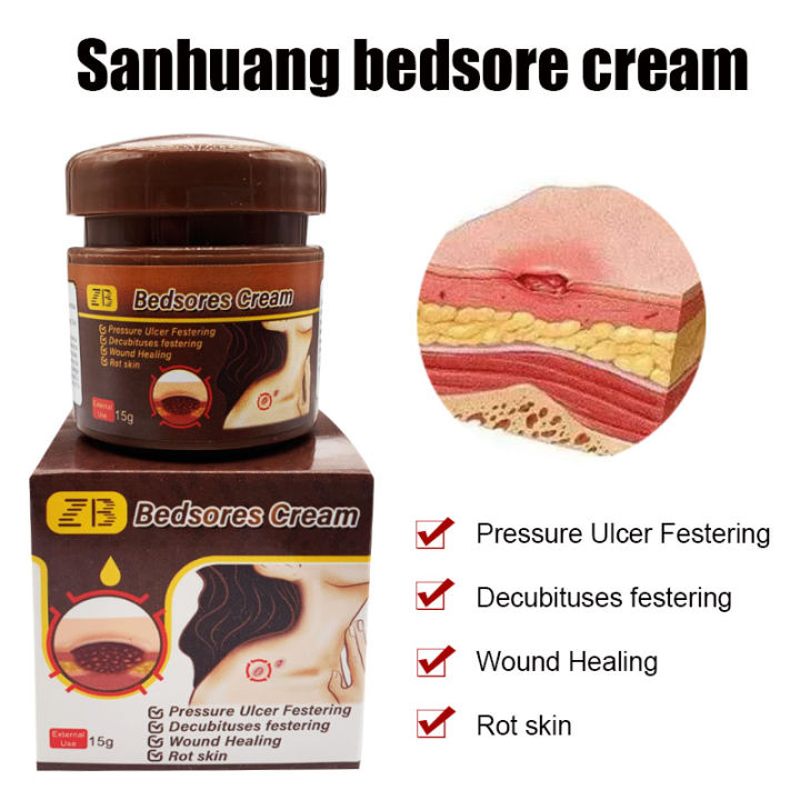 ZB Bedsores Bacteriostatic Analgesic Cream Skin Pressure Ulcer ...