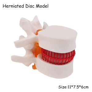 【READY STOCK】Human Nasal Cavity Model/Throat Anatomy Internal/Otolaryngology Medical Teaching Model/Throat Anatomy Model