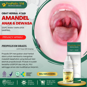 Obat Amandel 100% Alami Obat Amandel Kronis Obat Amandel Bengkak Obat Amandel Untuk Anak / Dewasa Obat Radang Amandel Obat Radang Tenggorokkan Obat Benjolan di Tenggorokan Obat Sakit Tenggorokan dan Susah Menelan - PROPOLIS SM BRAZIL