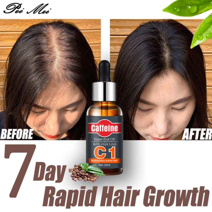 30ml Fast Hair Growth Essential Oils Authentic 100% Hair Loss